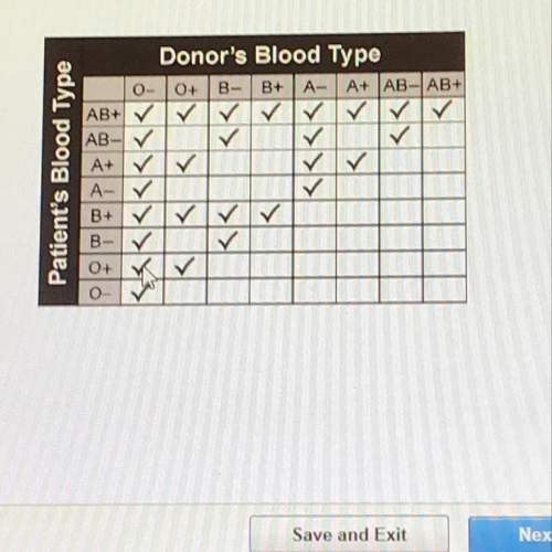 Based on the chart below, if a patient can receive only blood types o- o+ b-, and b+ which blood typ