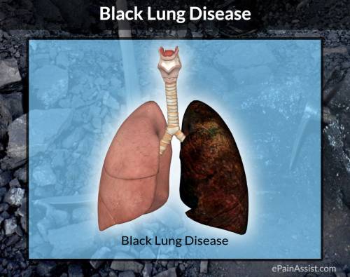 Which condition is also known as black lung disease?