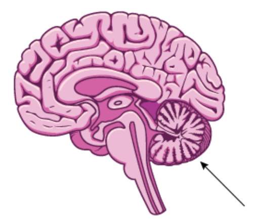 Which brain structure is identified by the arrow in the figure?  a. cerebellum b.