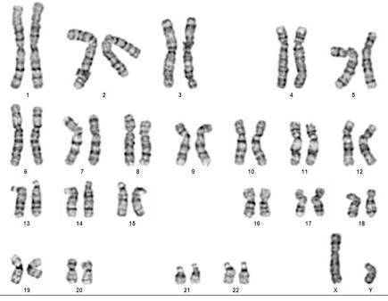 Doctors would have to find cells in which phase of the cell cycle to make a proper karyotype-interph