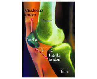 What size force does the femur exerts on the kneecap if the tendons are oriented as in the figure an