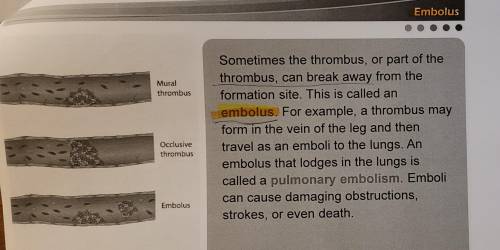 What is the difference between embolus and thrombus