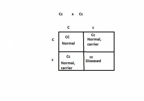 Cystic fibrosis (cf) is a recessive trait that causes a fatal lung disorder, with symptoms beginning