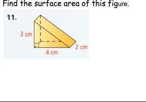 (very easy) find the surface area of this figure