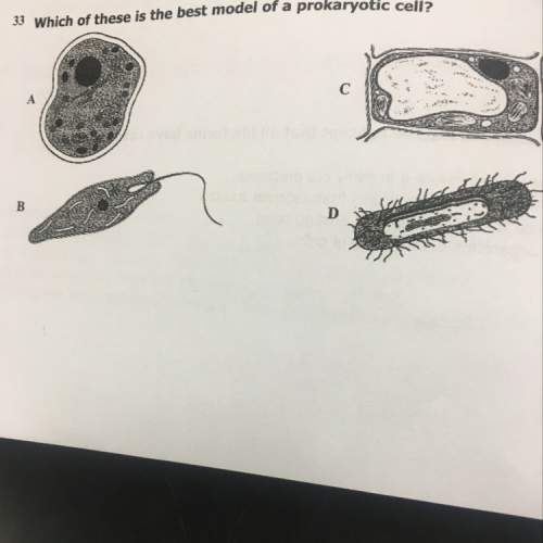 Which of these is the best model of a prokaryotic cell?