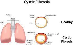 Many different types of mutations can occur within the body. cystic fibrosis is a genetic disorder t