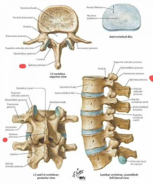 Which of the following pairs is correctly matched? A) lumbar vertebrae; bifid spinous processes B) t
