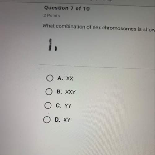 What combination of sex chromosomes is shown in the image