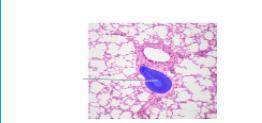 Which structures are highlighted? Which structures are highlighted? pulmonary arterioles alveoli bro