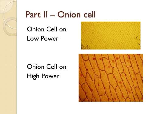 Sketch what you observe when examining the onion root tip using the low-power lens and the high-powe