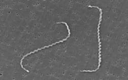 Onsider this microscopic image of bacteria.  a oval b rod shaped c spherical