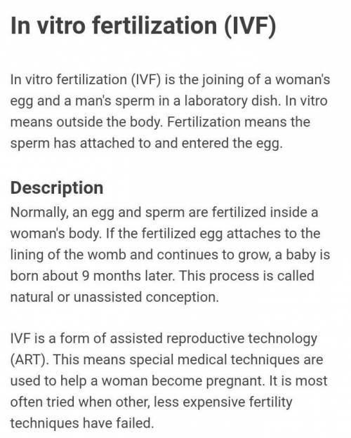 Explain the term of IVF, surrogacy, sperm Bank​
