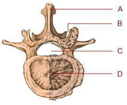 Where is the foramen in this diagram of a bone from the vertebral column?

A. 
option A
B. 
option B