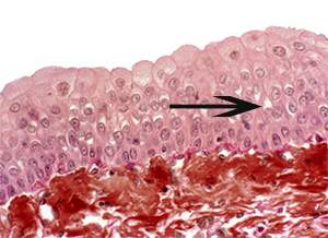 The slide image shows epithelium tissue found in the bladder. what is the function of the tissue ind