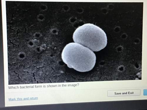 Consider this microscopic image of bacteria  which bacterial form is shown in the image?