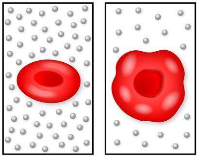 The image on the left shows a normal red blood cell, and the image on the right shows a cell that ha