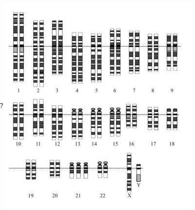 Study the karyotype carefully. what can you identify to be true about this child this is