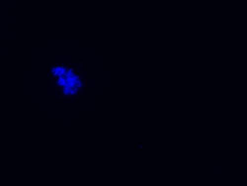Is this image of cells considered to be going through apoptosis or prophase? it kind of looked like