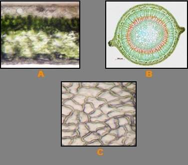 Identify the plant tissues in the three images. a. is dermal b. is vascular&lt;