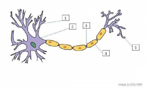 Analyze the image below and answer the question that follows.

A horizontal neuron. The large, leafy