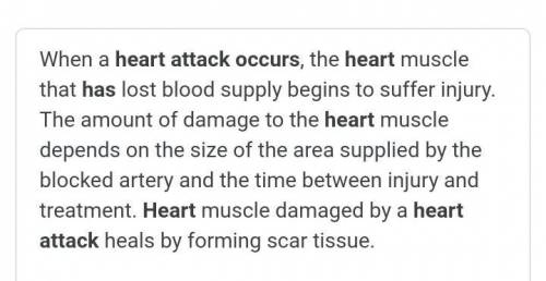 Pls help

Give brainless 
Discuss ONE effect of heart attack on biological
structure/s, & justif