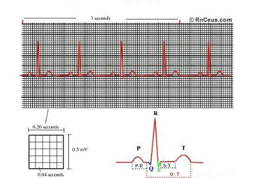 How to calculate the heart rate from the electrocardiogram ?​