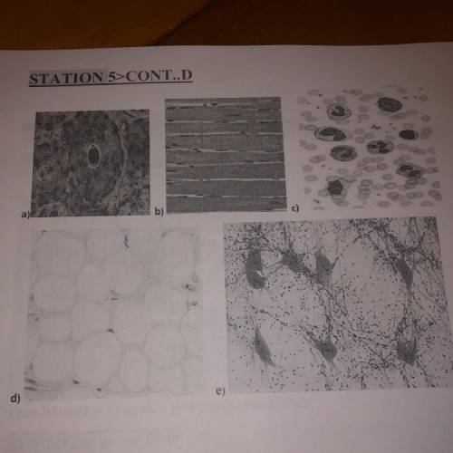 List at least 3 TYPES of tissue cells vou would expect to see on the bone marrow biopsy slide  CHOOS