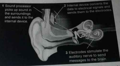 The diagram above shows how a cochlear implant works. Then James has difficulty in hearing but the c