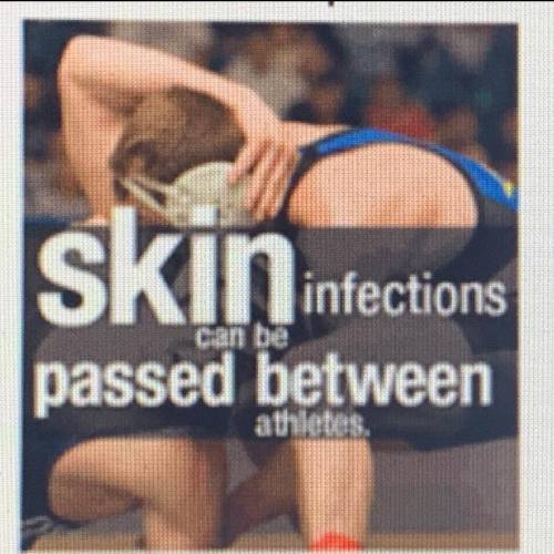 Preview the poster and identify the main idea a. Athletes share infections b. Infections are contagi