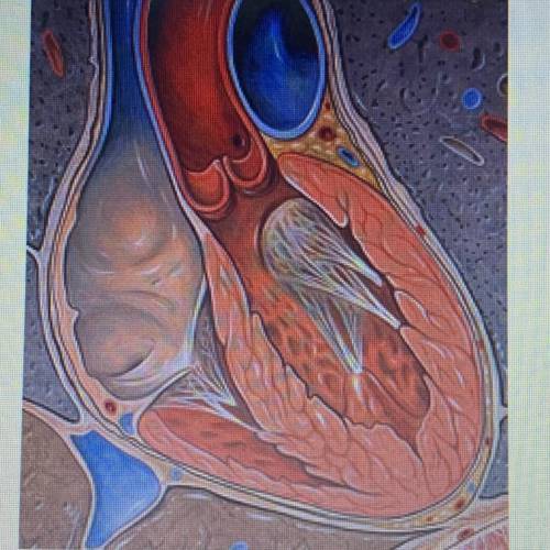The picture below accurately depicts a healthy heart. The left ventricle has a thicker myocardium th