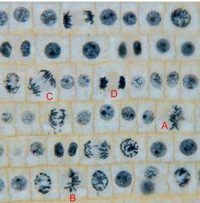 Which labeled cell (A,B,C,D) represents a cell in anaphase? How did you know?