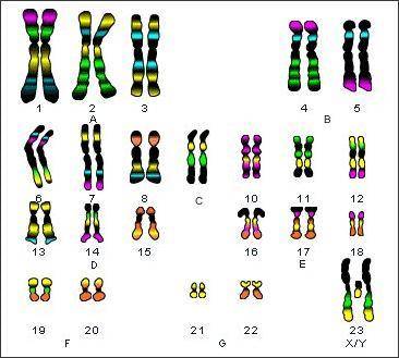 Describe an individual with the karyotype shown. A. a normal female B. a normal male C. an infertile