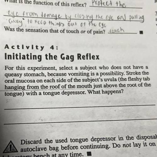 Activity #4 answer on gag reflex