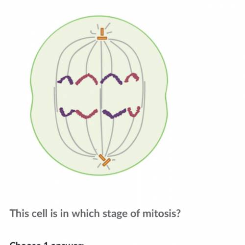 This cell is in which stage of mitosis?