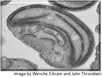 What is shown in the image? prokaryote eukaryote chloroplast mitochondrion