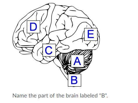 Name the part of the brain labeled