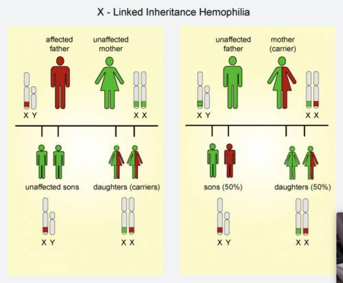 Hemophilia is a sex-linked genetic disorder that inhibits the blood’s ability to clot properly. The