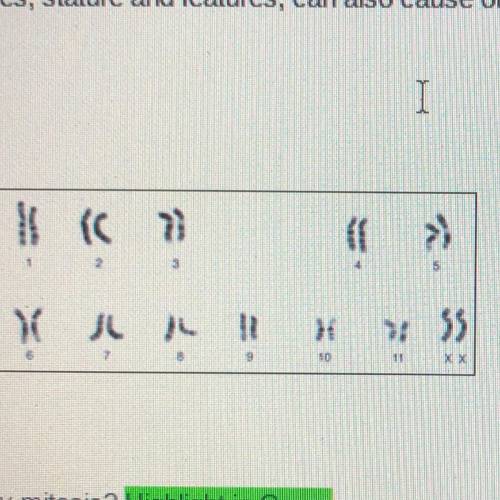 Look at the Karyotype on the right hand side and answer the following questions: a) What is the hap