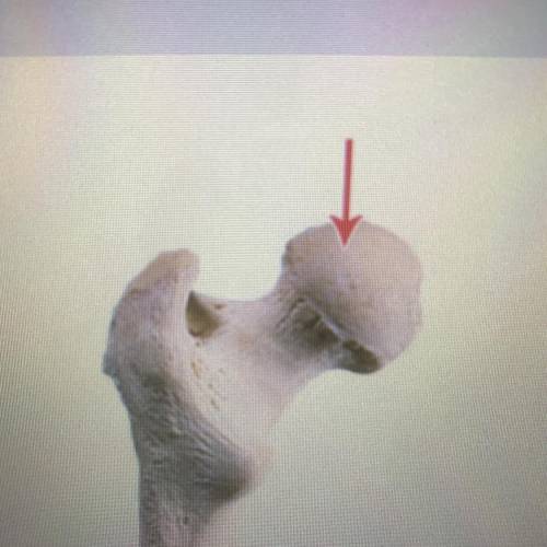 The image above shows an anterior view of the superior end of the femur. What type of bone structur