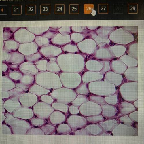 Which level of organization is shown in the image?

O cell
O tissue
organ
organ system