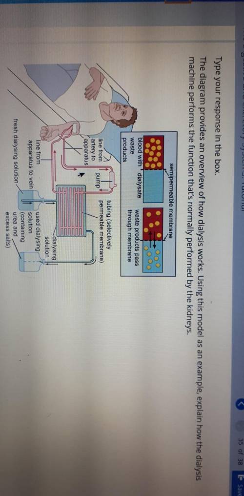 The diagram provides an overview of how dialysis works. Using this model as an example, explain how