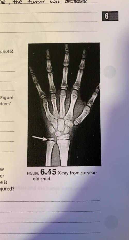 A. identify the bones in the X-ray

b. your colleague thinks there may be a fracture present at th