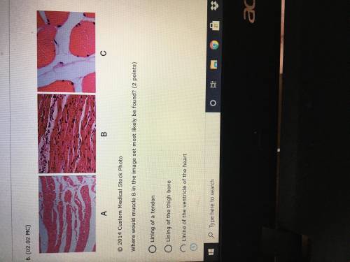 Where would muscle B in the image set most likely be found

A. Lining of a tendon 
B. Lining of a