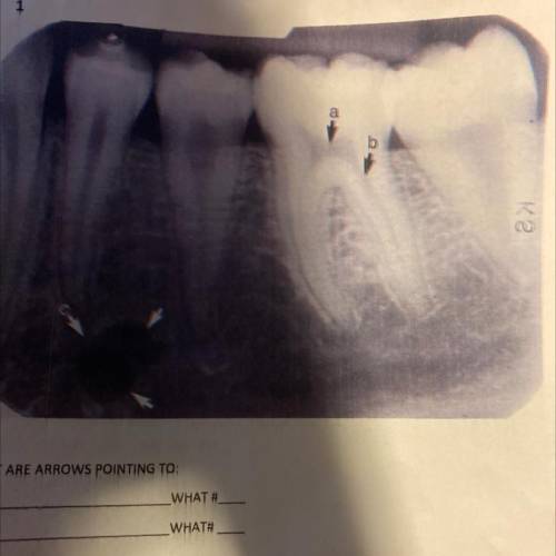 WHAT ARE ARROWS POINTING TO:

A.
WHAT #
B.
WHAT#
C.
WHAT TYPE OF FILM IS THIS?
(Dentistry)