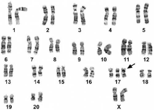 Answer the following questions about the Karyotype below:

1. Is the individual in the karyotype a