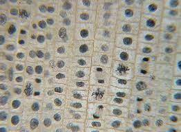 The above picture is cells of an onion root tip. The majority of the cells are in Interphase becaus