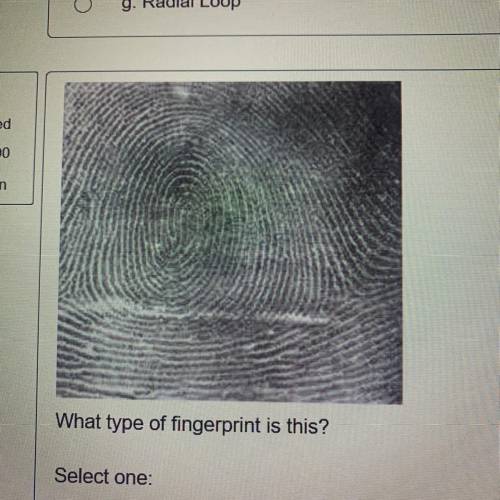 What type of fingerprint is this?

Select one:
a. Radial loop
O
b. Double loop whorl
c. Ulnar loop