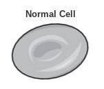 The image below represents a normal cell.

Which image shows what will happen to the normal cell w