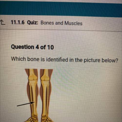 Which bone is identified in the picture below?
A. Ulna. B. Radius. C. Scapula. D. Tibia