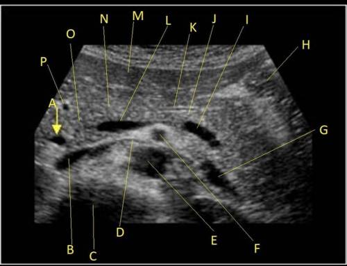 Label ultrasound image can’t find anywhere

Just 
P-
O-
L-
I-
K-
D-
B-
F-
E-
M-